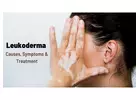 Skin Care Solutions For Vitiligo (Leucoderma)? Dermatologist Explains