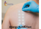 The Best Allergy Patch Test at Reasonable Cost