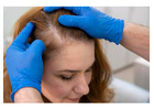 Non Sergical Hair Replacement Dallas