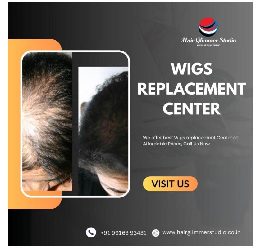 Non-Surgical Hair Replacement | Wigs Replacement Center