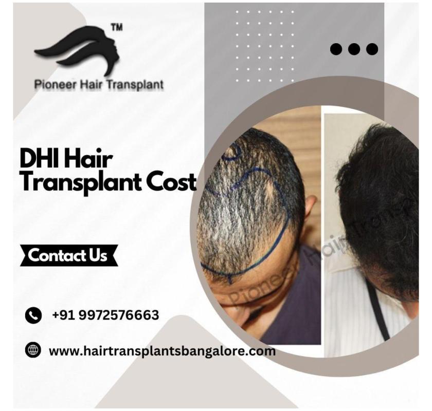 DHT Hair Transplant Bangalore | DHI Hair Transplant Cost