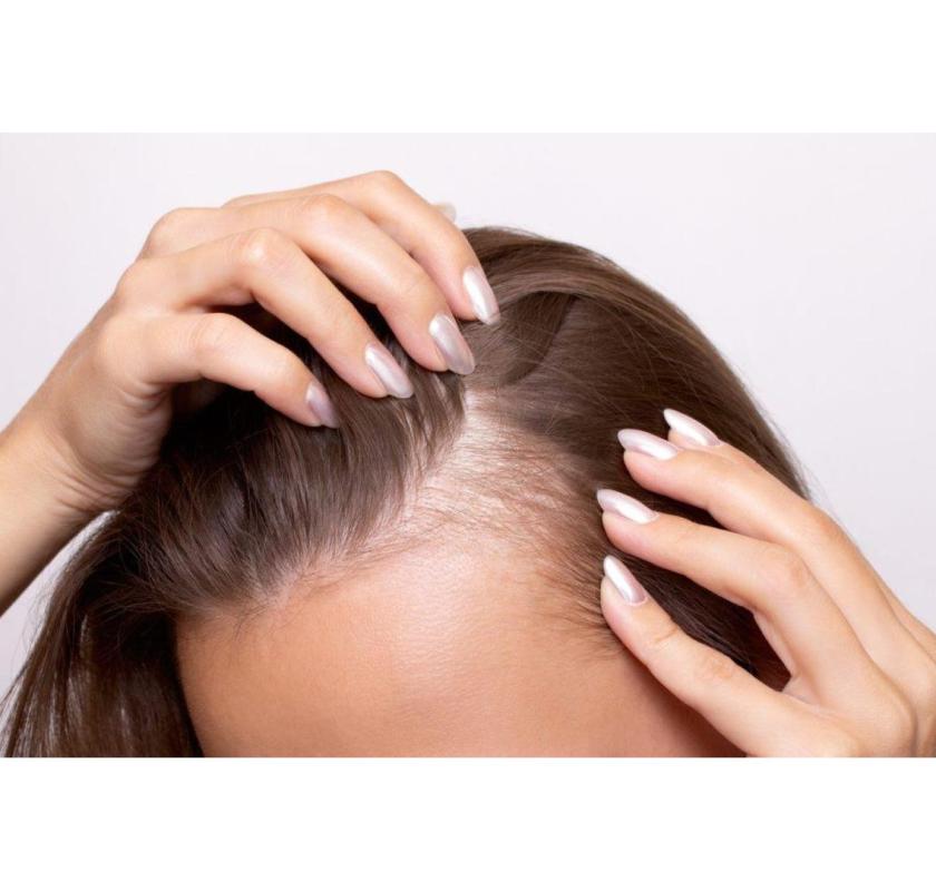 Dallas Hair Loss Solutions