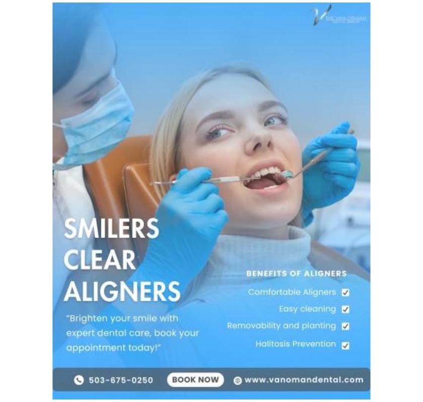 Are Smilers Clear Aligners Worth It ?