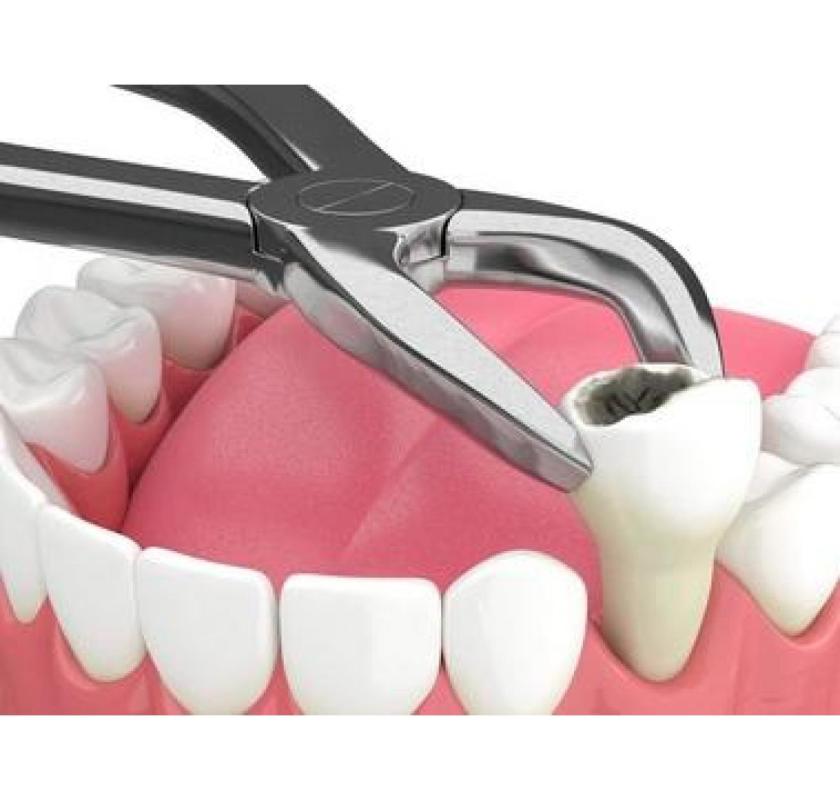  Restore Your Smile with Lasting Solutions