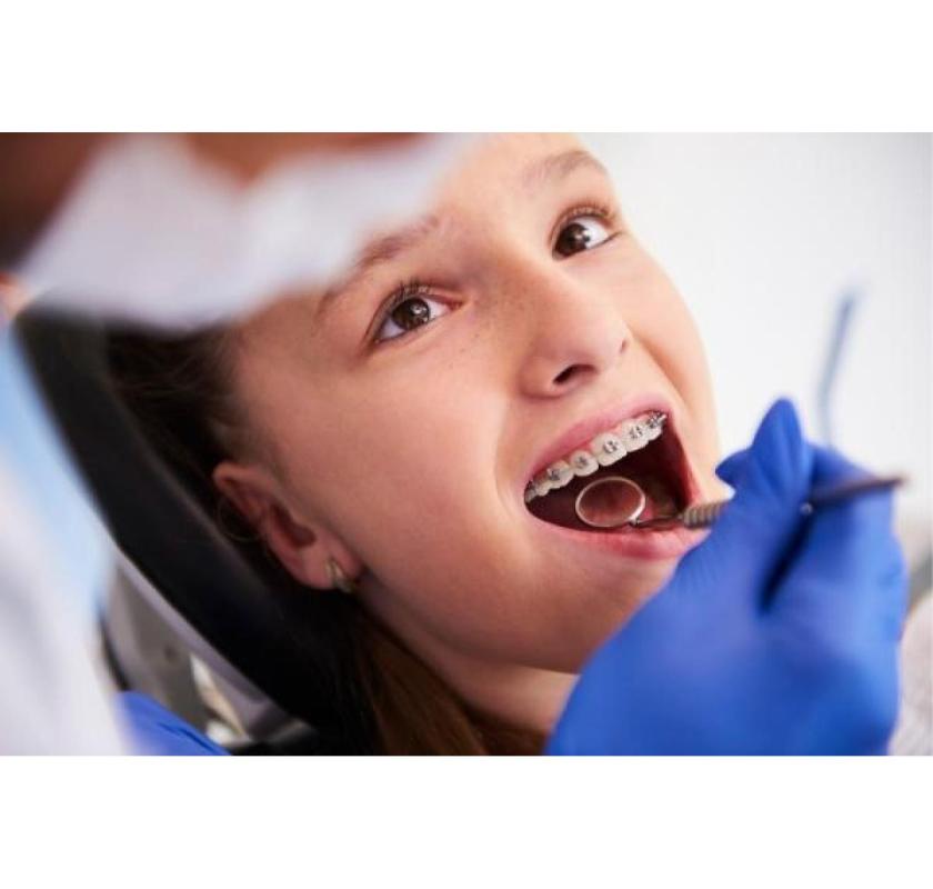 Best Braces Treatment In Gurgaon