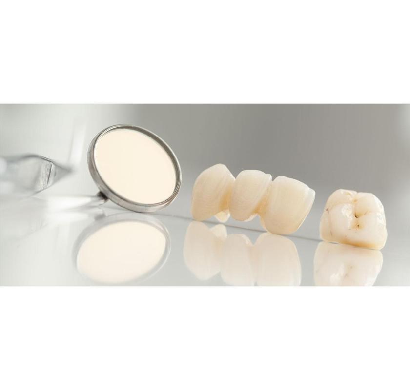 Dentist Payment Plan Canberra