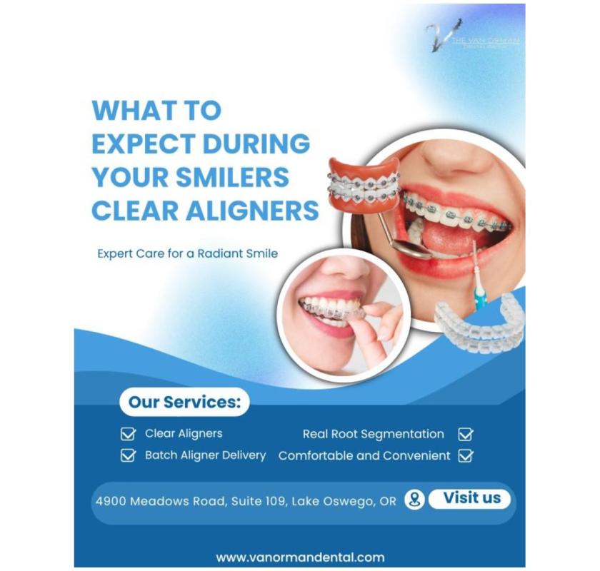What to Expect During Your Smilers Clear Aligners Journey