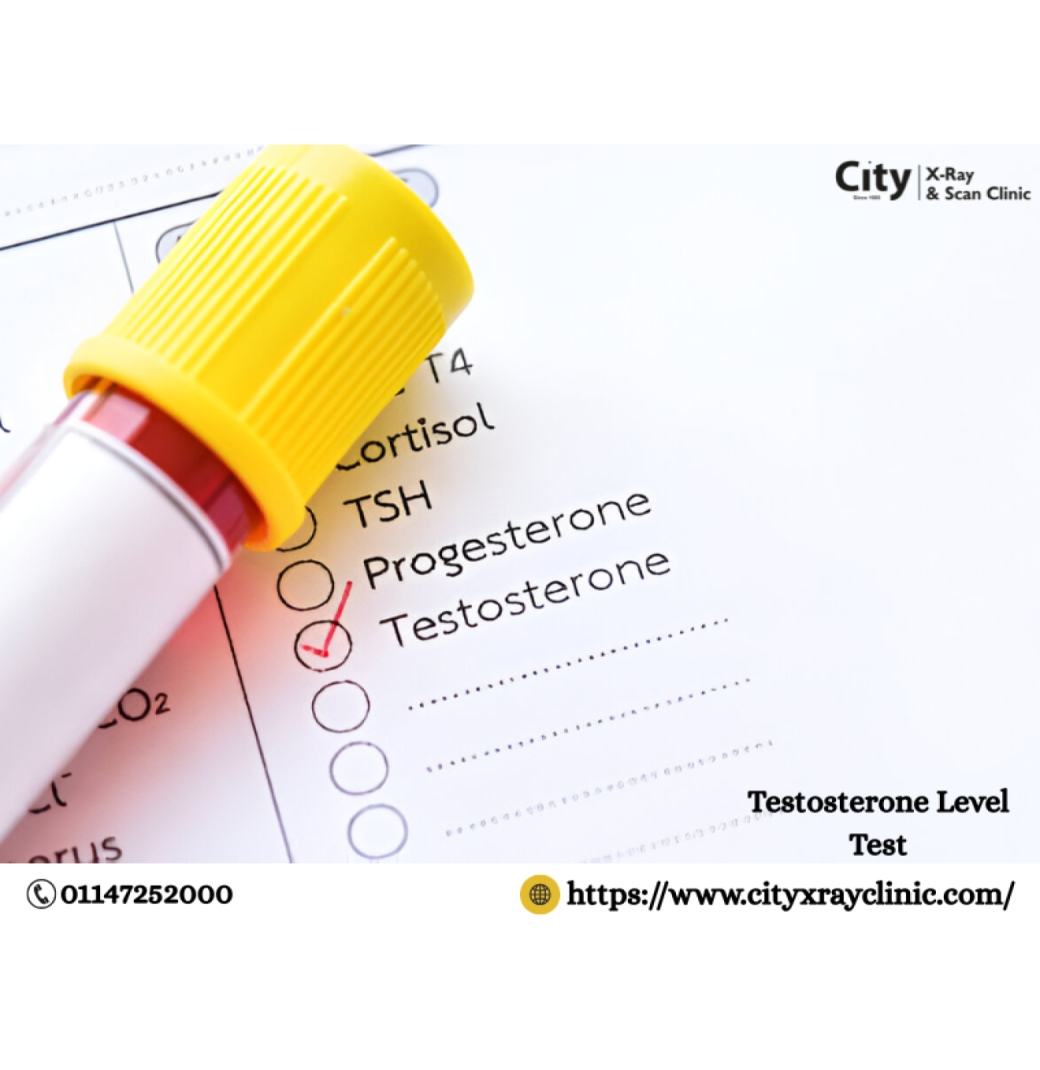 Know Testosterone Level Test Price in Your City Today