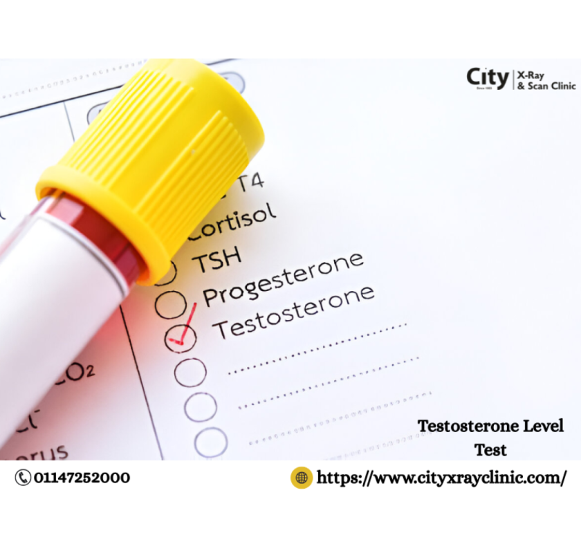 Know Testosterone Level Test Price in Your City Today