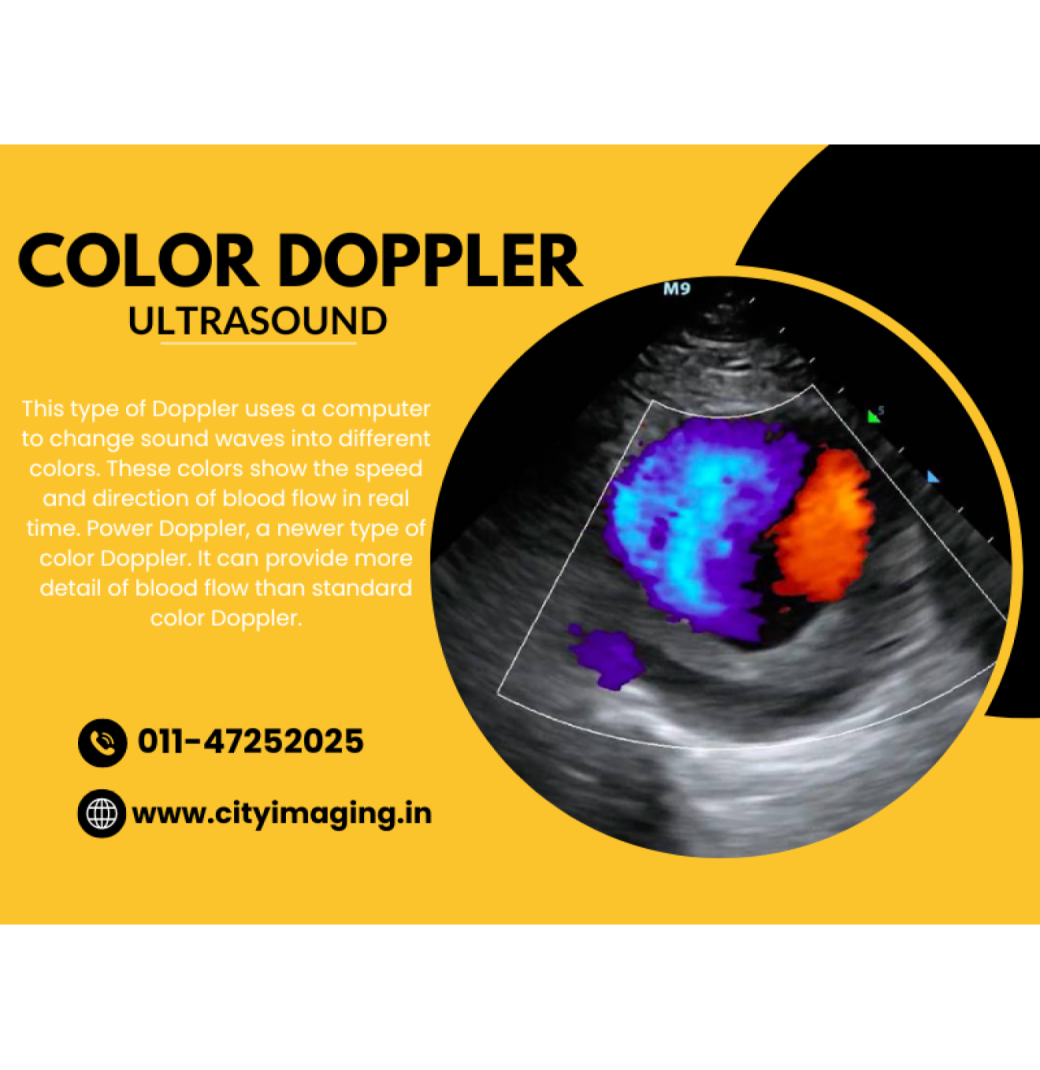 Know Colour Doppler Test Price Near You Today 