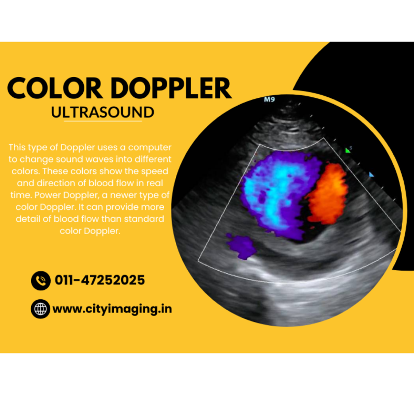 Know Colour Doppler Test Price Near You Today 