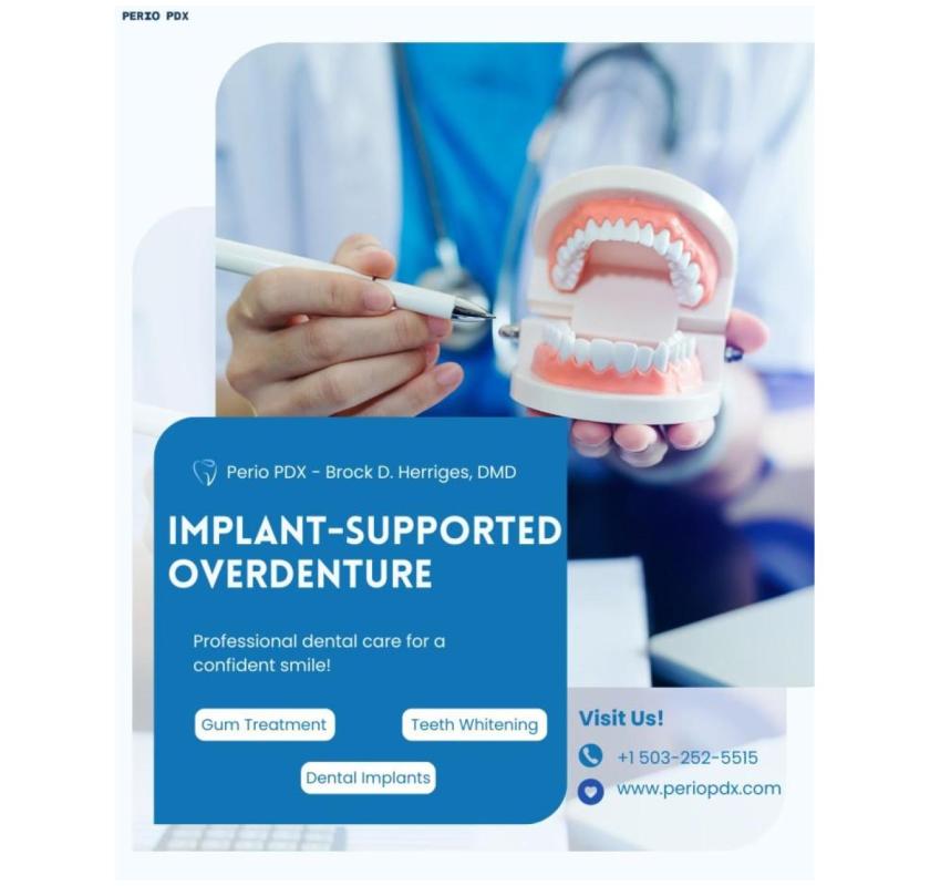 How Implant-Supported Overdenture Performs ?