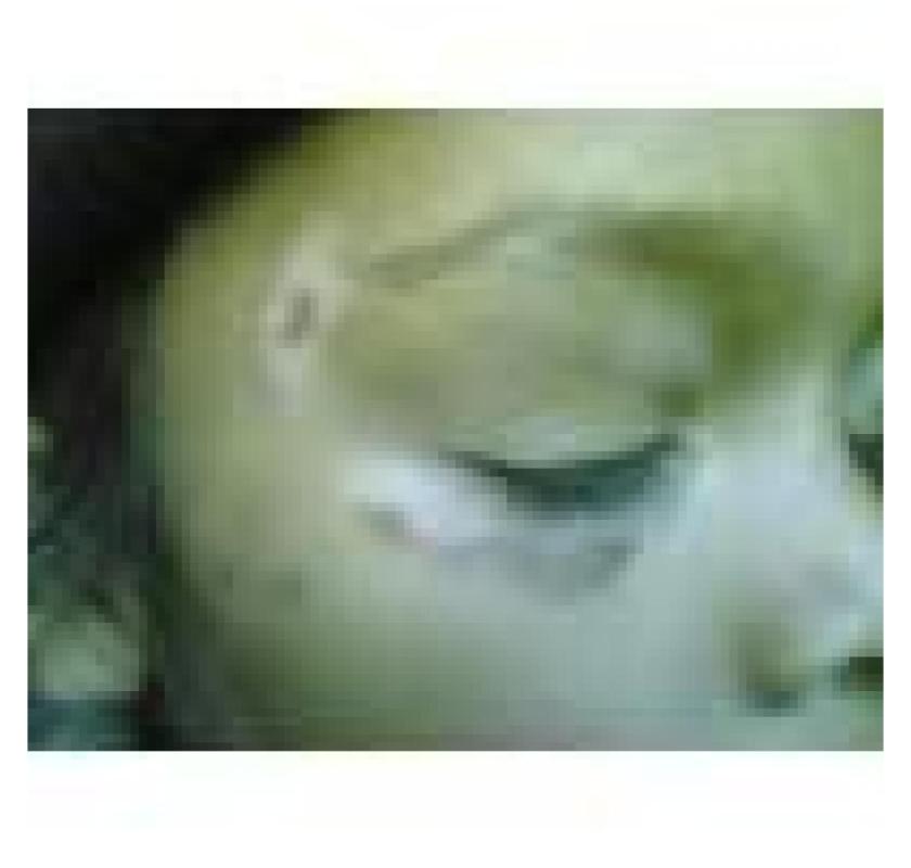 AROGYAM PURE HERBS KIT FOR VITILIGO