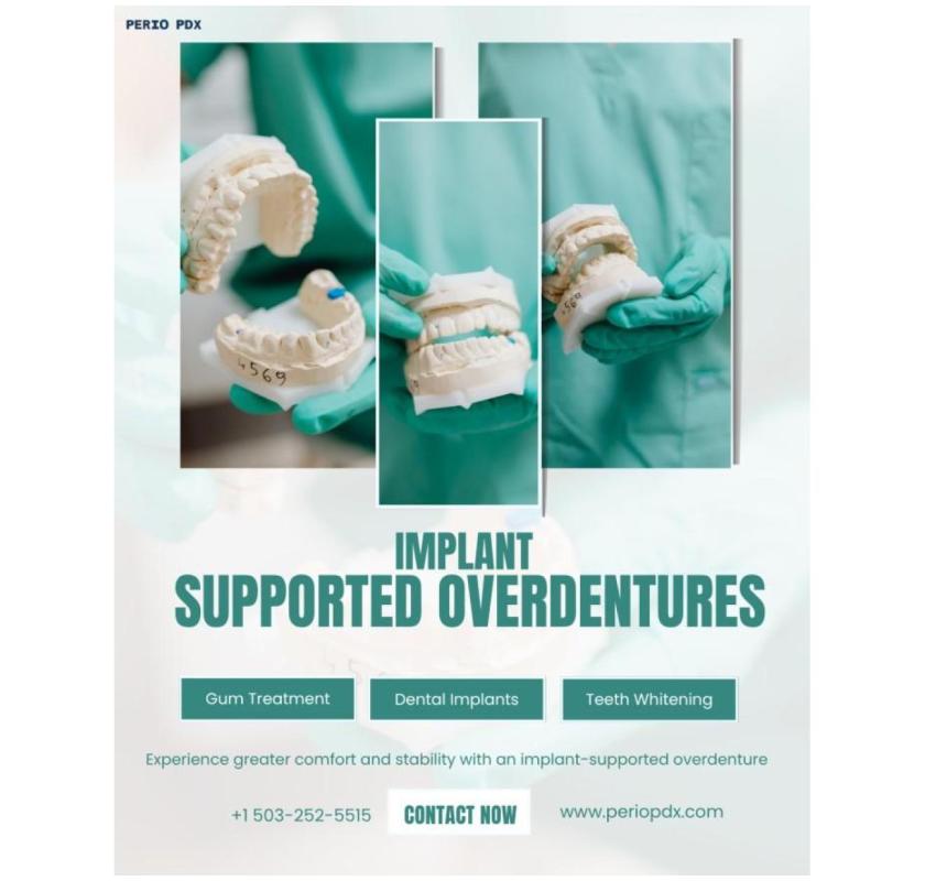 How Long Do Implant-Supported Overdentures Last?