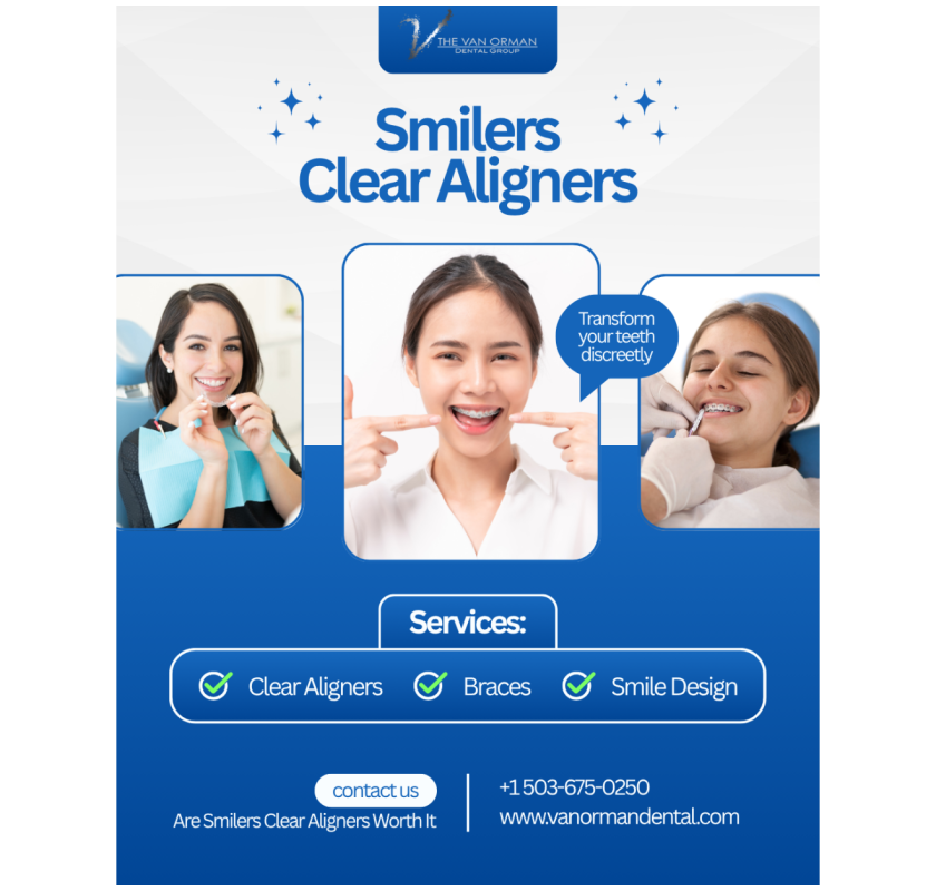 Do Smilers Clear Aligners Really Work?