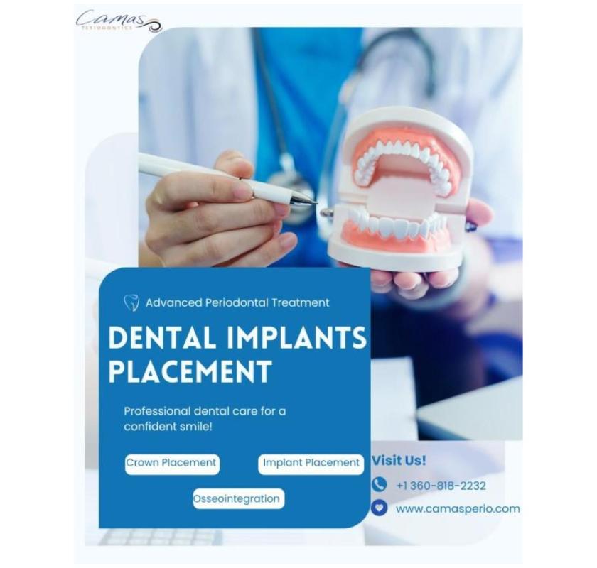 Are Dental Implants Right for Seniors?