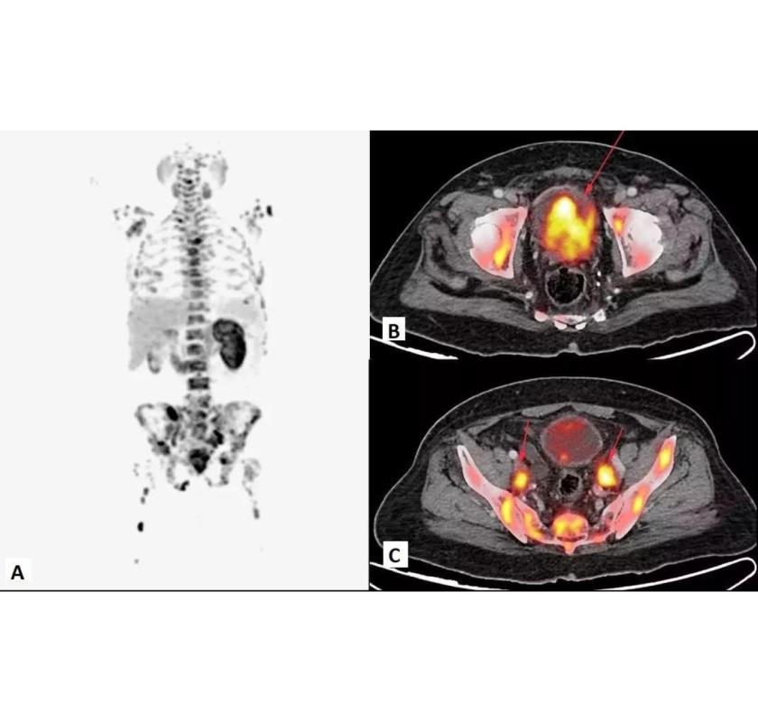 Book a PET Scan in Mumbai at Picture This Imaging 