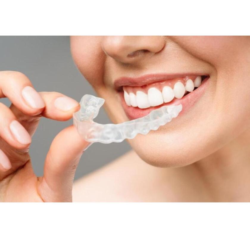 How The Smiler Clear Aligners Work?