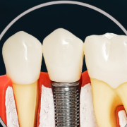 heritage family dental